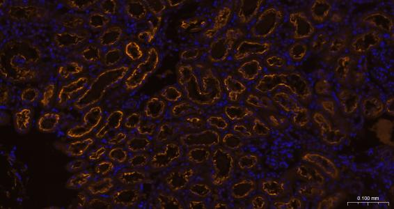 糖蛋白gp330重组兔单抗