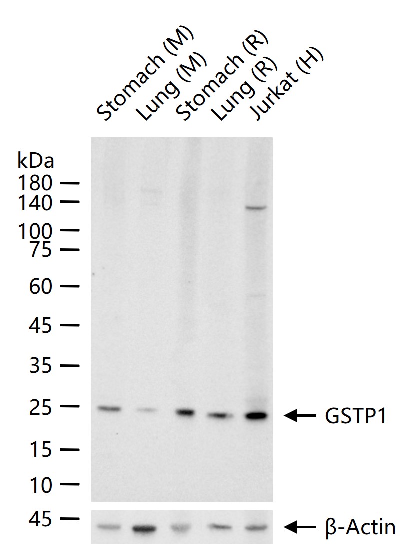 GSTP1 Rabbit pAb (一抗) - WB,IHC-F,IF | Bioss