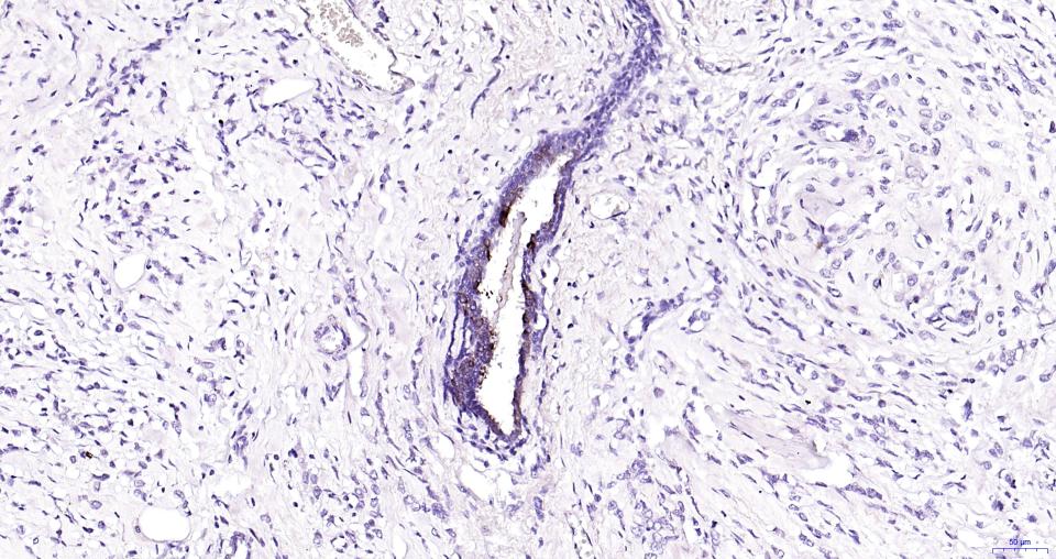 乳铁蛋白重组兔单抗