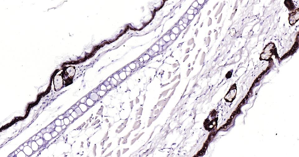 细胞角蛋白15重组兔单抗