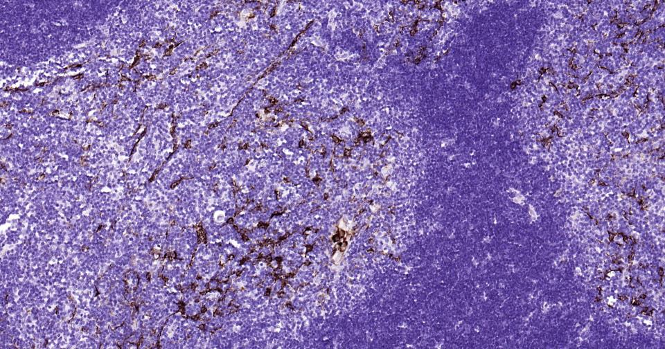 细胞角蛋白15重组兔单抗