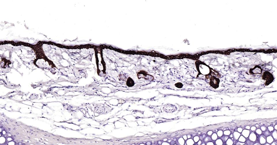细胞角蛋白15重组兔单抗