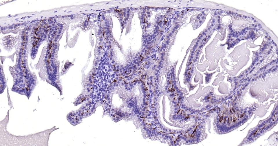 细胞角蛋白15重组兔单抗
