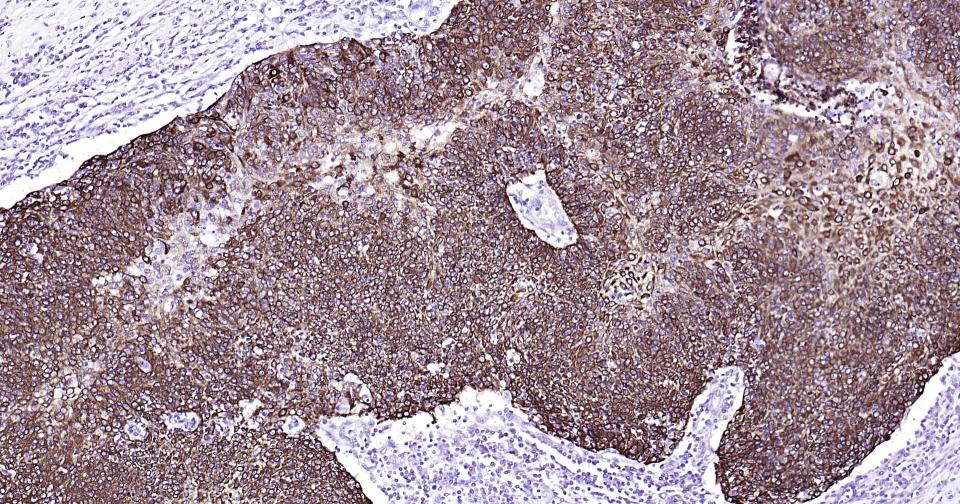 细胞角蛋白15重组兔单抗