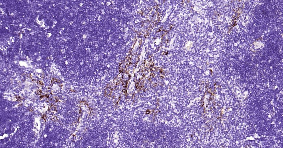 细胞角蛋白15重组兔单抗