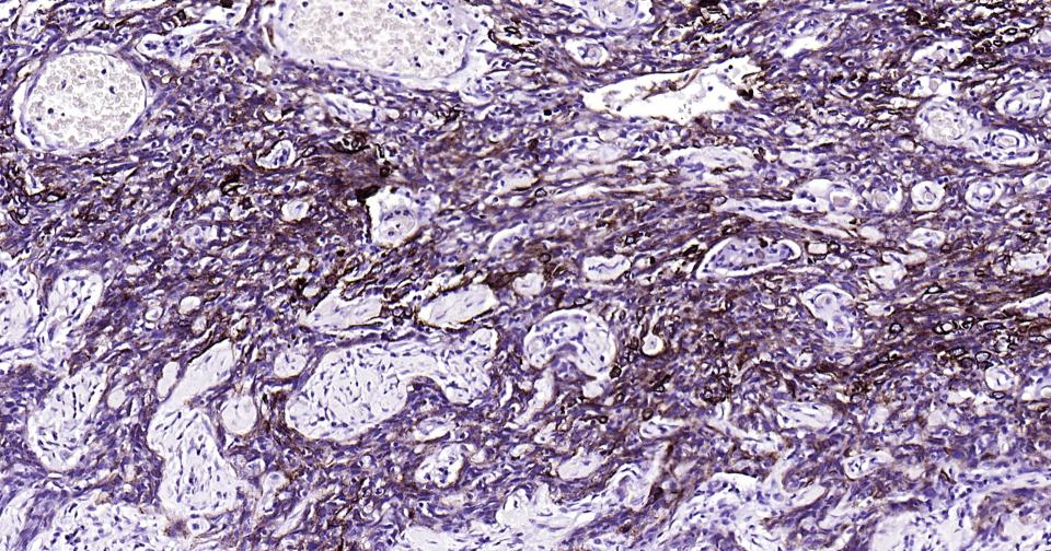 细胞角蛋白15重组兔单抗