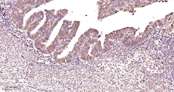 氨基末端激酶1/3重组兔单抗