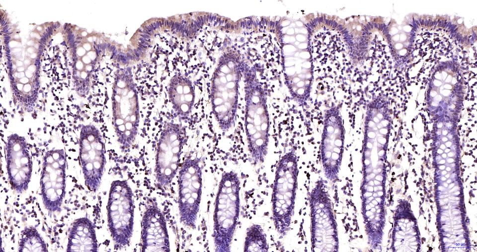 氨基末端激酶1/3重组兔单抗