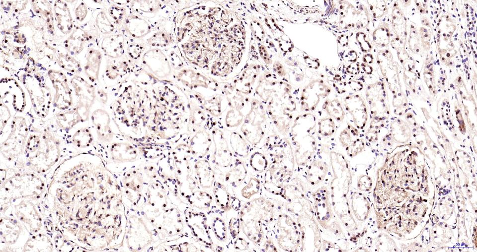 氨基末端激酶1/3重组兔单抗