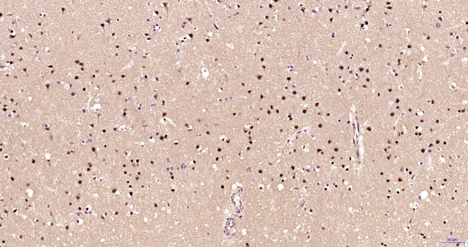 氨基末端激酶1/3重组兔单抗