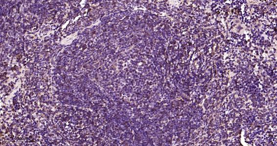 氨基末端激酶1/3重组兔单抗