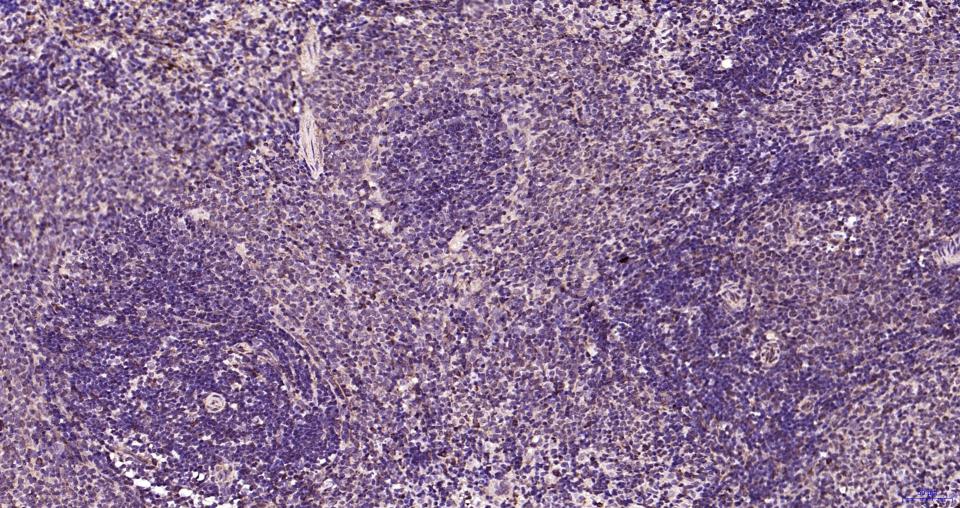 氨基末端激酶1/3重组兔单抗