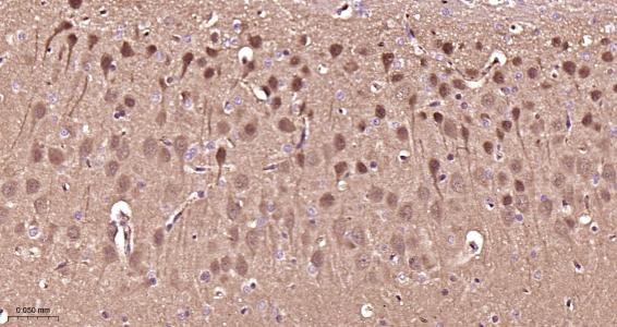 氨基末端激酶1/3重组兔单抗