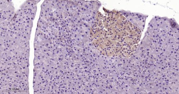 硫氧环蛋白还原酶1重组兔单抗