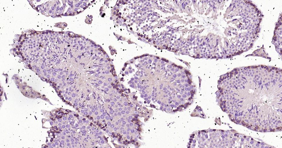 Rho相关蛋白激酶1重组兔单抗