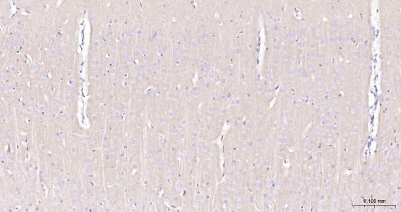 G氨基丁酸B型受体2重组兔单抗