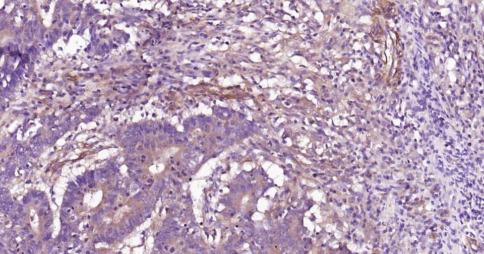 Rho相关蛋白激酶1重组兔单抗