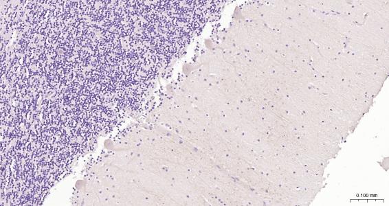G氨基丁酸B型受体2重组兔单抗