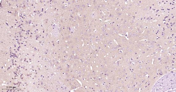 Presenilin 1 Recombinant Rabbit mAb (一抗) - IHC-P,IHC-F,IF,Flow-Cyt | Bioss