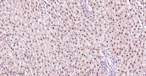 肝细胞核因子4α重组兔单抗