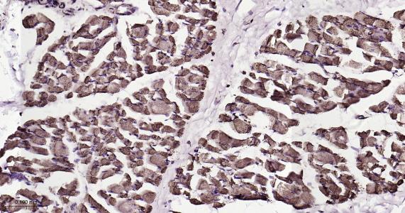 ATP5A重组兔单抗