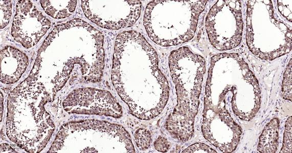 硫氧环蛋白还原酶1重组兔单抗