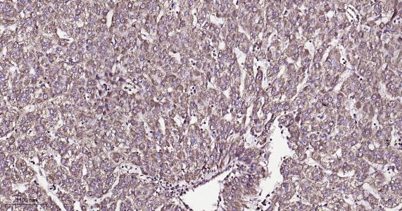 ATP5A重组兔单抗