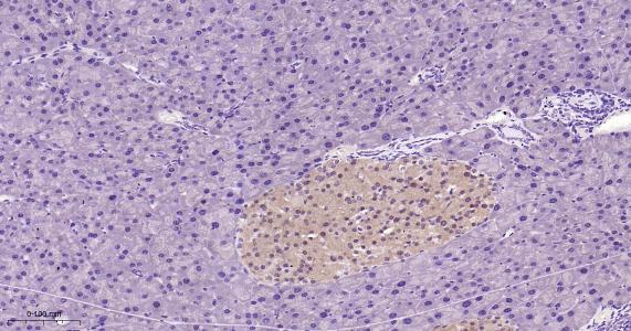 硫氧环蛋白还原酶1重组兔单抗