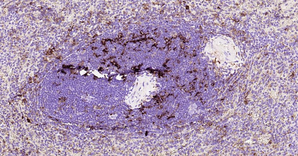 HLA-DR重组兔单抗