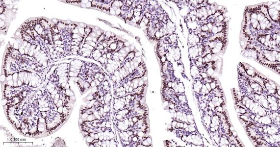 肝细胞核因子4α重组兔单抗