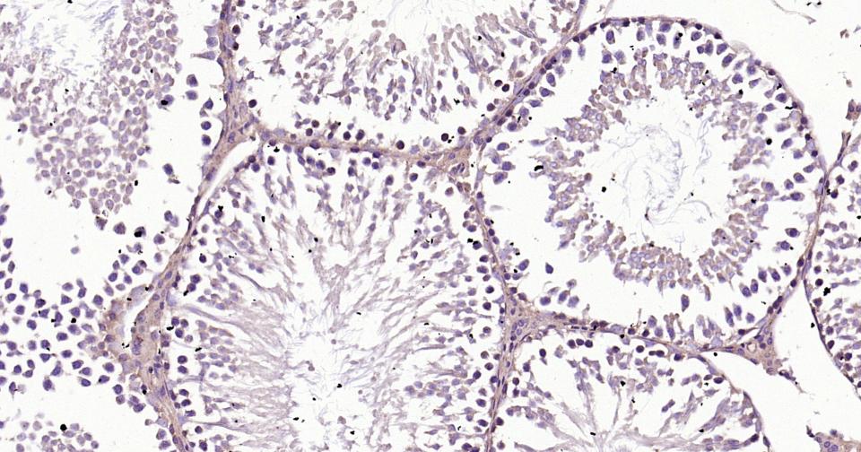 Rho相关蛋白激酶1重组兔单抗