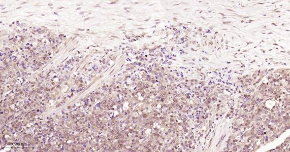 硫氧环蛋白还原酶1重组兔单抗