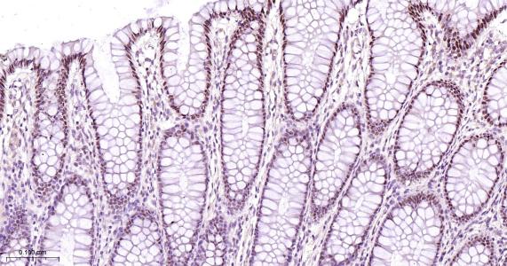 肝细胞核因子4α重组兔单抗