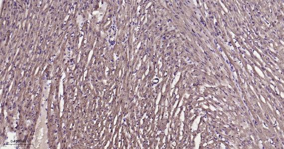 ATP5A重组兔单抗