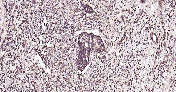 p21激活激酶1重组兔单抗