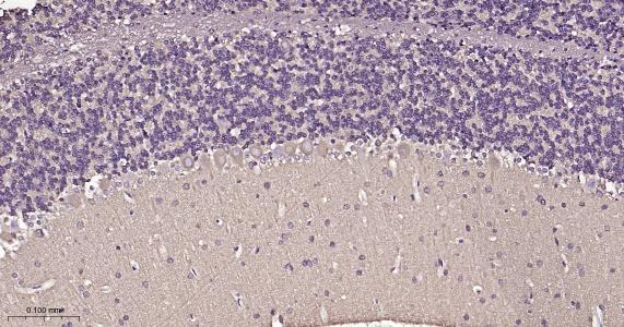 微管蛋白β1 tubulin(内参)重组兔单抗