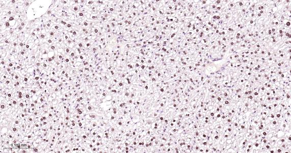 肝细胞核因子4α重组兔单抗