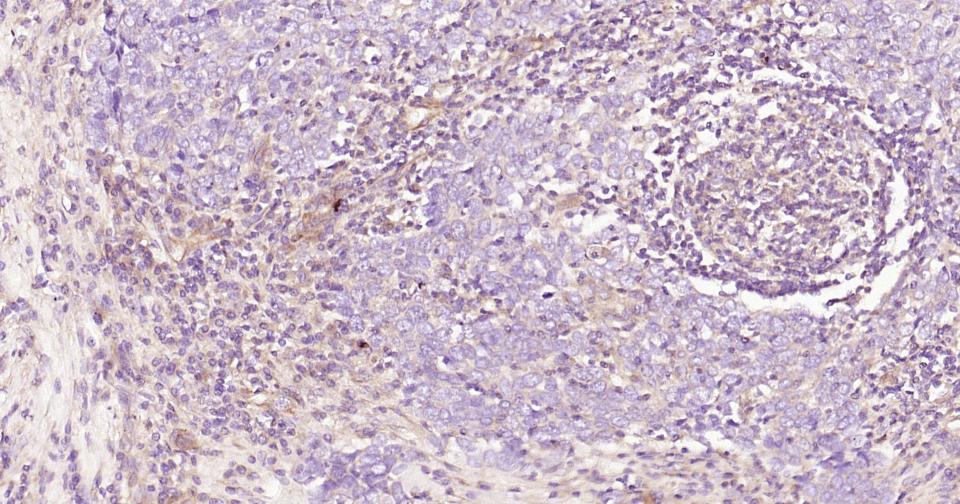 Rho相关蛋白激酶1重组兔单抗