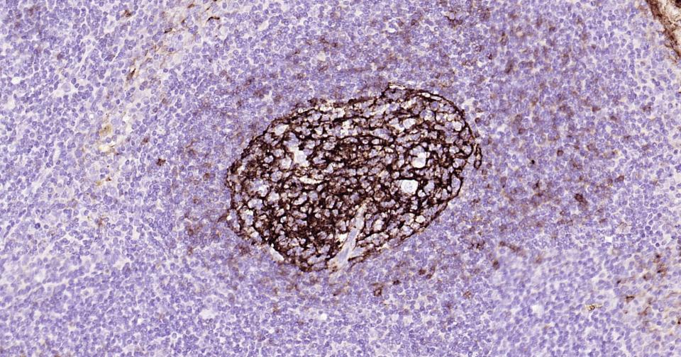 CD23 Mouse mAb (一抗) | Bioss