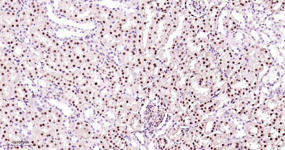 肝细胞核因子4α重组兔单抗