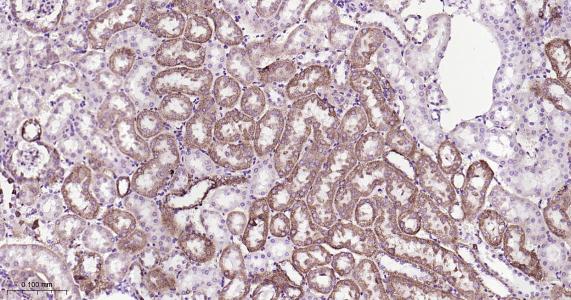 ATP5A重组兔单抗