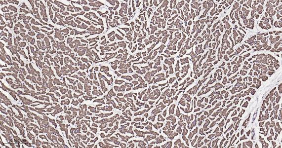 ATP5A重组兔单抗