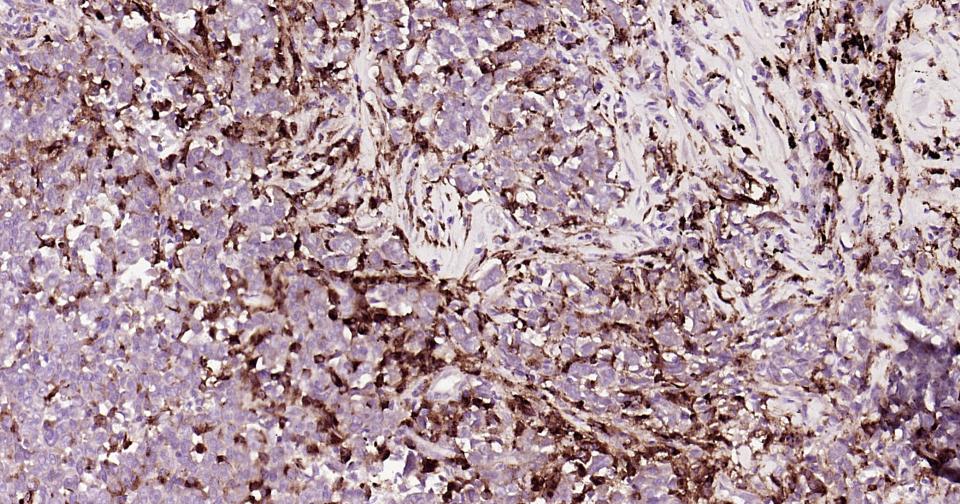 HLA-DR重组兔单抗