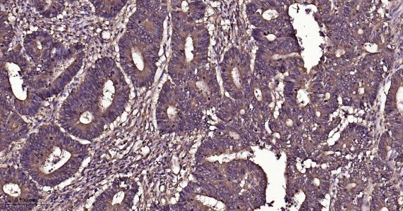 微管蛋白β1 tubulin(内参)重组兔单抗