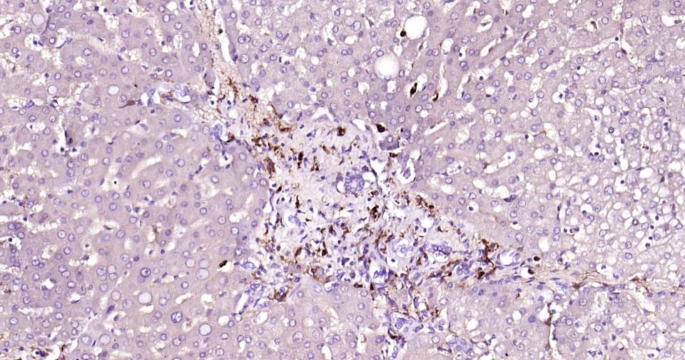 HLA-DR重组兔单抗