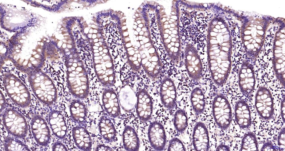 丝裂原活化蛋白激酶激酶2重组兔单抗