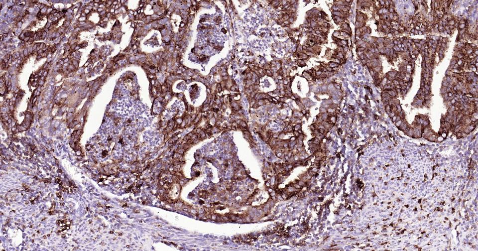 HLA-DR重组兔单抗