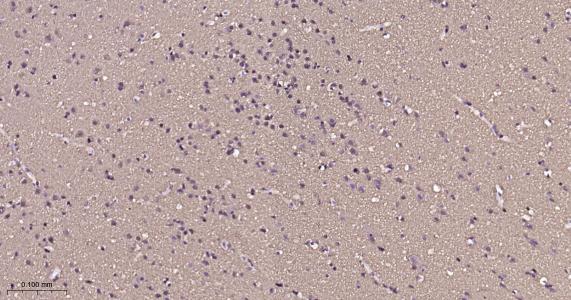 微管蛋白β1 tubulin(内参)重组兔单抗