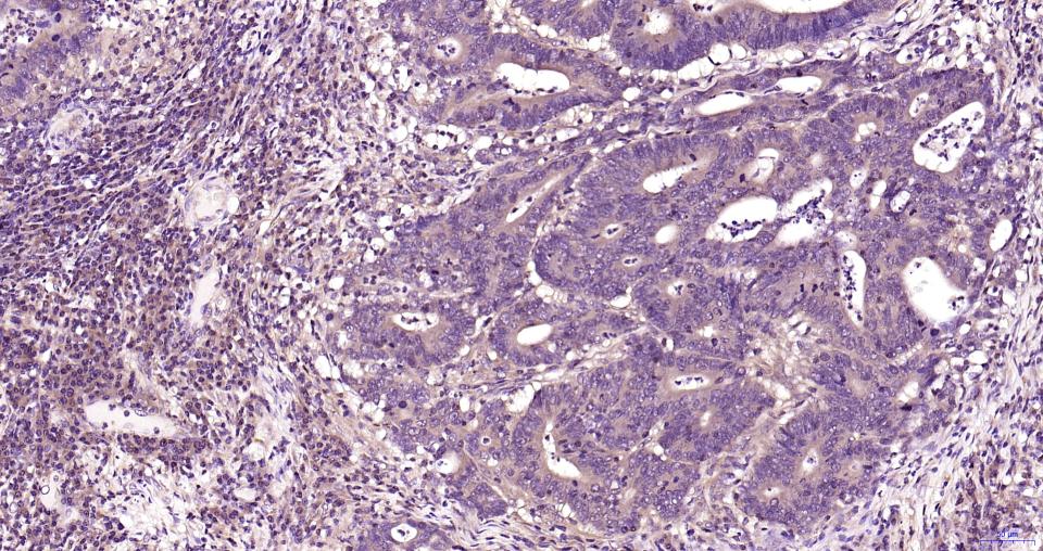 丝裂原活化蛋白激酶激酶2重组兔单抗