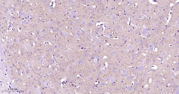 5-三磷酸肌醇受体1重组兔单抗